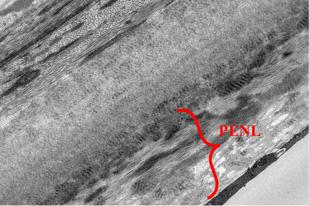 Pre-Endothelial Layer (PENL)